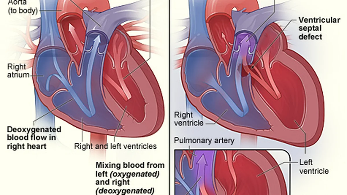 Congenital Heart Disease