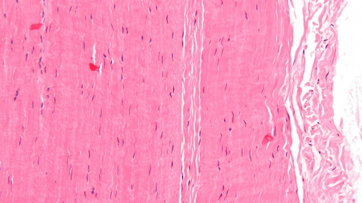 How Tendons and Ligaments Work