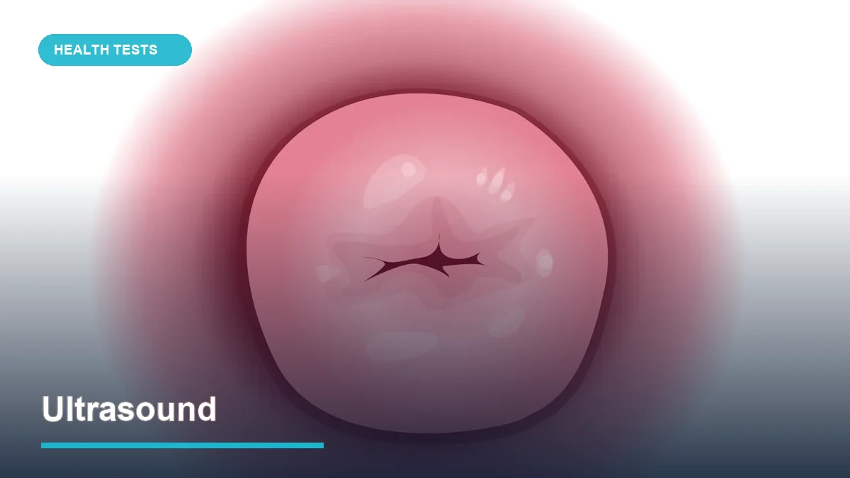 Ultrasound
