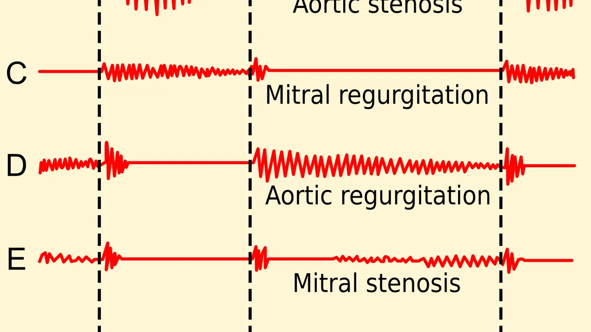 Valvular Heart Disease